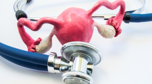 علاج قرحة الرحم