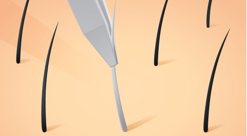 بصيلة الشعر بيضاء: إلى ماذا تُشير؟