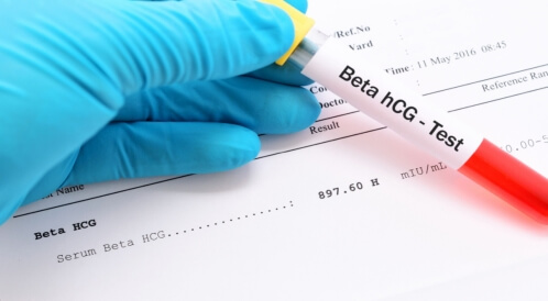 جدول نسبة هرمون الحمل بعد الحقن المجهري	