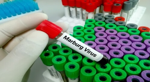 مرض فيروس ماربورغ: ماذا نعرف عنه؟