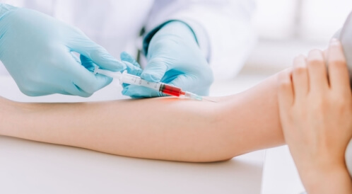 سحب الدم من الوريد: كيف يتم ذلك؟