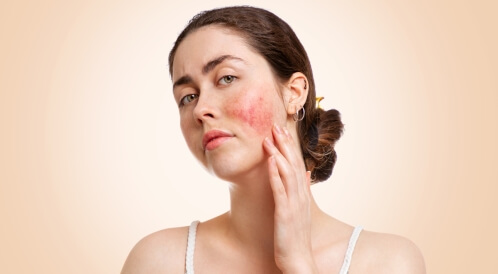 الوردية في الوجه: دليلك الشامل