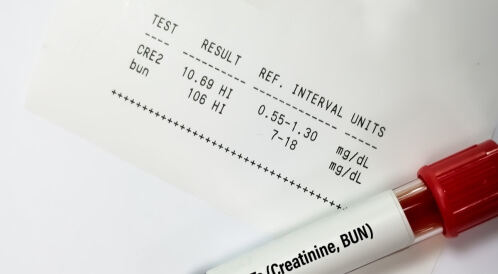 أسباب ارتفاع اليوريا والكرياتينين: أهم المعلومات