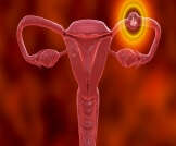 الحمل في قناة فالوب: الأسباب والأعراض والتشخيص والعلاج