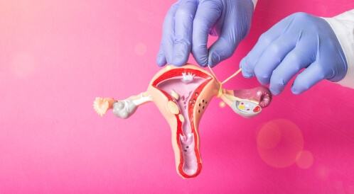 هل يمكن الحمل بعد عملية ربط قناة فالوب؟	