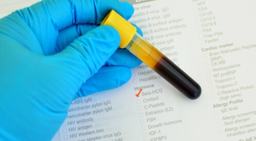 هرمون الحمل يرتفع ولكن لا يتضاعف: ما السبب؟