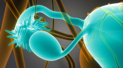 اعوجاج قناة فالوب: كل ما يهمك معرفته