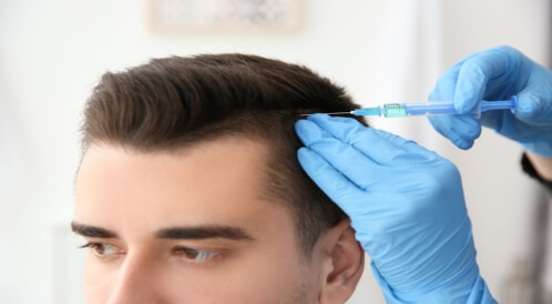 شروط زراعة الشعر: إليكم أبرزها