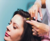 متى تظهر نتائج الخلايا الجذعية للشعر؟