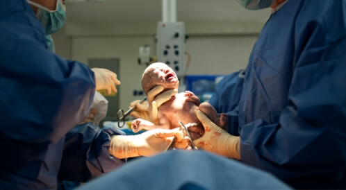 ما هي فوائد الولادة القيصرية؟