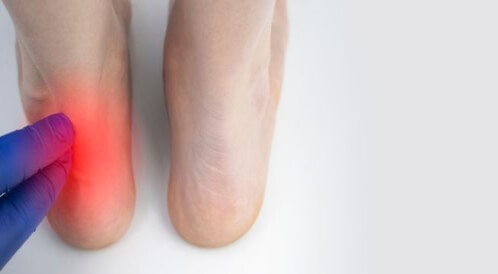 تمزق وتر العرقوب: سؤال وجواب