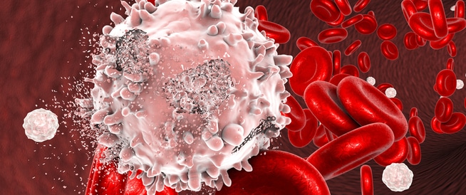 طرق علاج سرطان الدم: تعرف عليها  