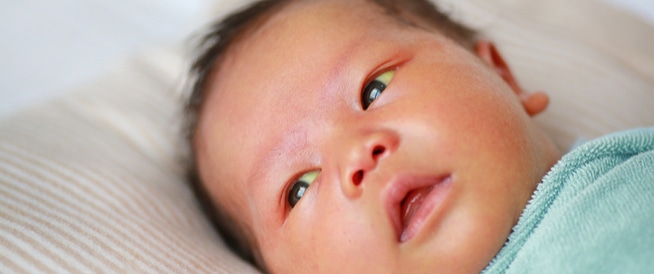 اليرقان عند حديثي الولادة: الأعراض، والأسباب، والعلاج