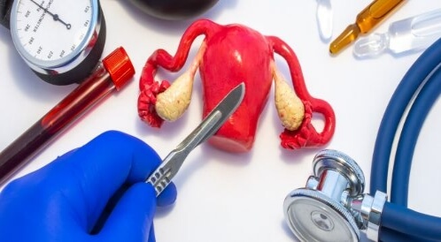 ما هي فوائد عملية استئصال الرحم؟