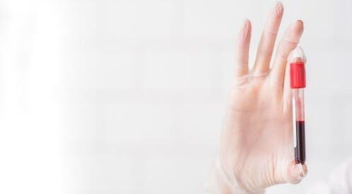 هل سرطان الفم يظهر في تحليل الدم؟