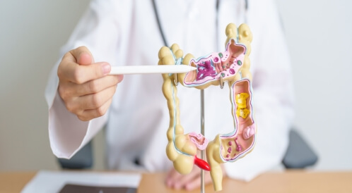 ما هي طرق علاج التهاب الرتج في المنزل؟