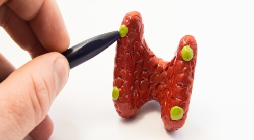 ما أسباب ارتفاع نسبة الغدة الجار درقية؟