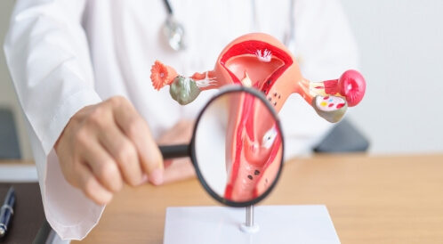 هل يمكن الشفاء من بطانة الرحم المهاجرة؟