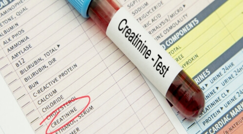 أعراض نقص الكرياتينين