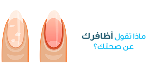الأظافر والصحة: إليك ما يجب معرفته