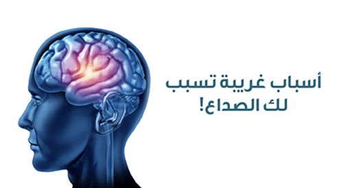 أسباب الصداع الغريبة: إليك بعضًا منها