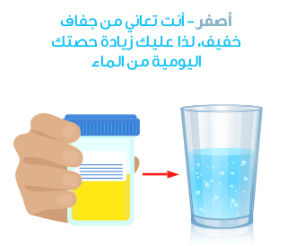 أعراض الإصابة بالجفاف: راقب نفسك لمعرفتها