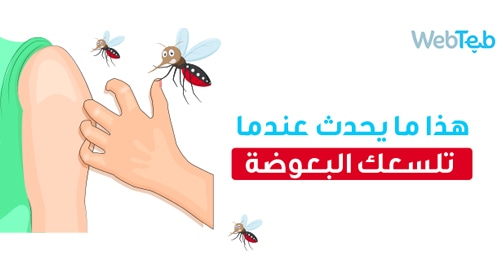 هذا ما يحدث عندما يلسعك البعوض