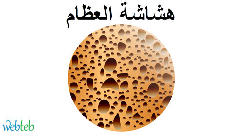 شاهد بالفيديو: أنواع هشاشة العظام