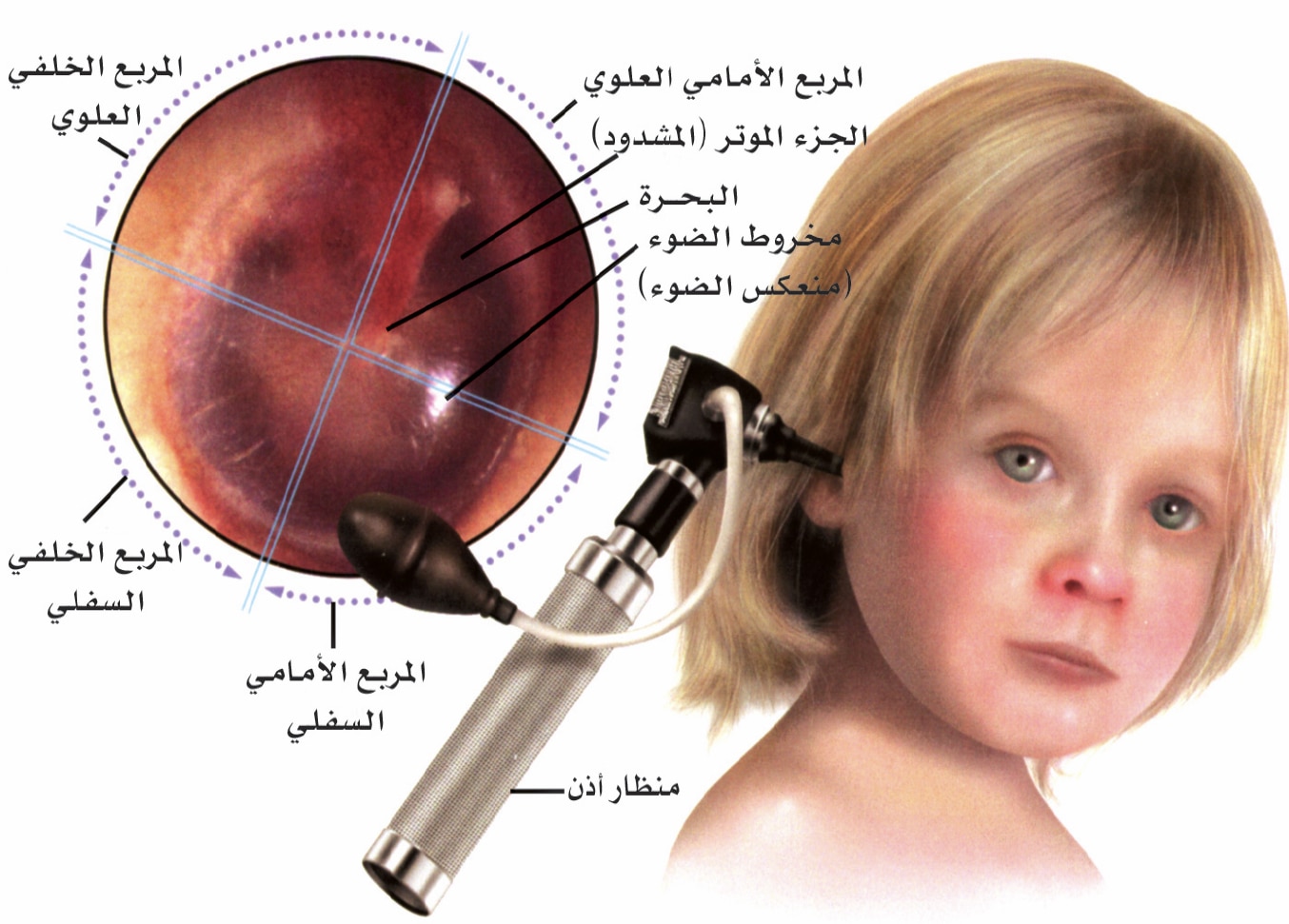 الاذن الاطفال التهاب عند علاج التهاب