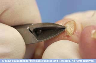 انزع قطع صغيرة