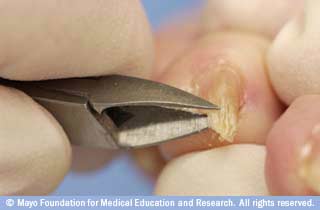 قم بالقص على التوالي