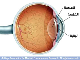 الساد  ومشاكل نظر أخرى متعلقة بتقدم السن