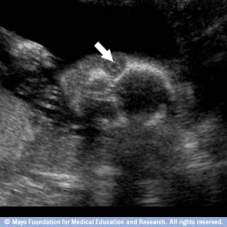 عيون الجنين