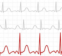 https://static.webteb.netتخطيط القلب الكهربي