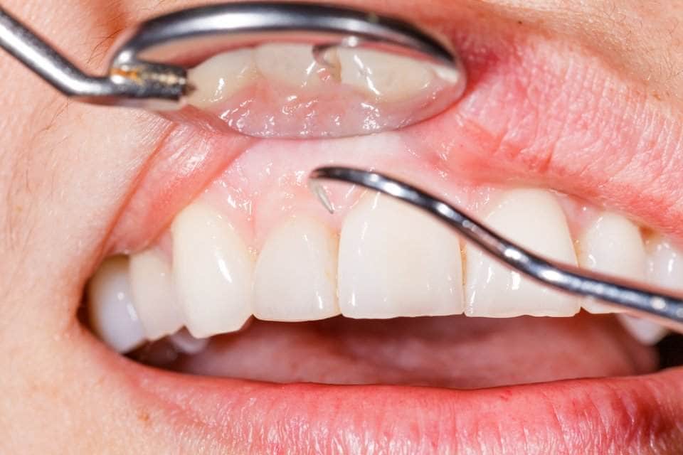 اسنان ولثة صحية