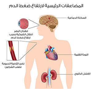 توضيح لمضاعفات ارتفاع ضغط الدم