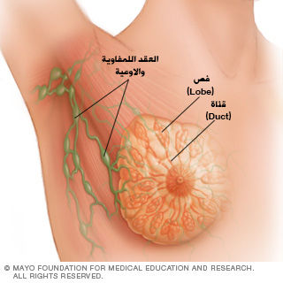 مراحل تطوّر سرطان الثدي بالصور - ويب طب