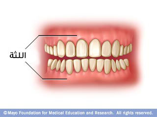 اللثة: الزهري يعني صحي اللثة: الزهري يعني صحي