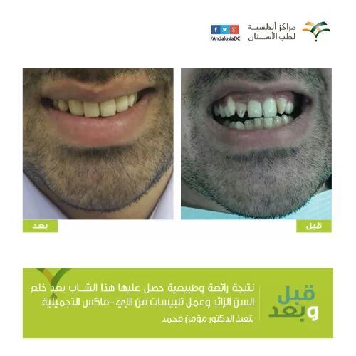 مؤمن مكاوى